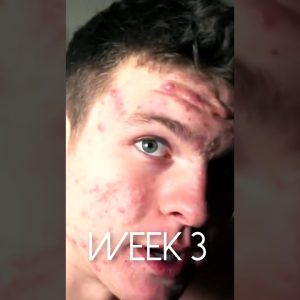 1767802716 maxresdefault