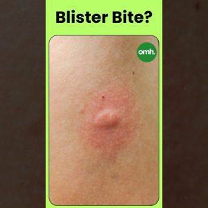 1767872282 maxresdefault