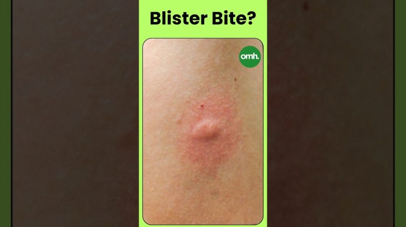 1767872282 maxresdefault