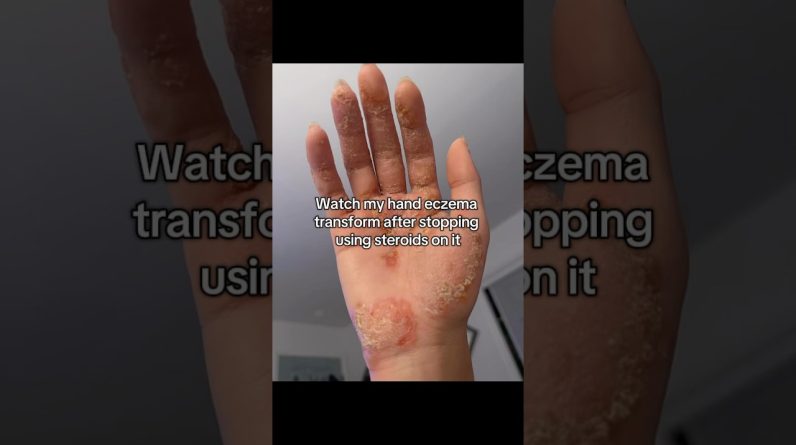 1767875937 maxresdefault