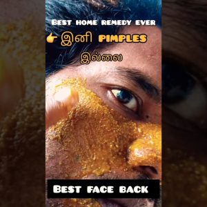 1767921706 maxresdefault