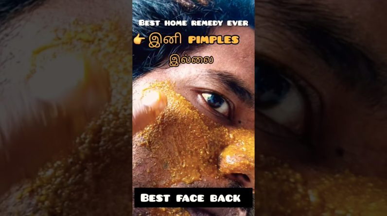 1767921706 maxresdefault