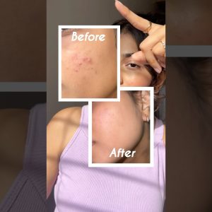 1767946002 maxresdefault