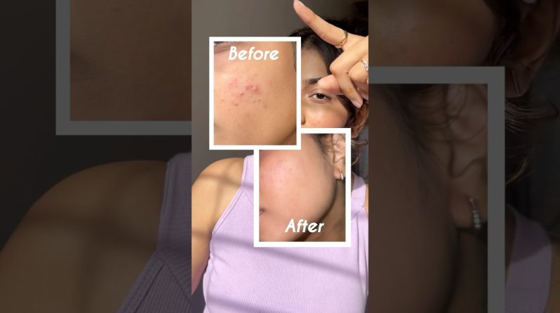 1767946002 maxresdefault