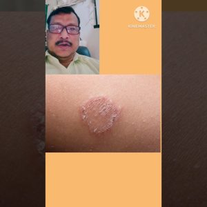 1767960556 maxresdefault