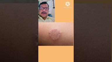 1767960556 maxresdefault