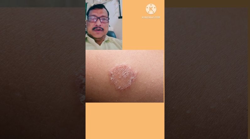 1767960556 maxresdefault