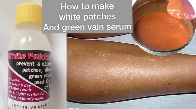 1767960886 maxresdefault