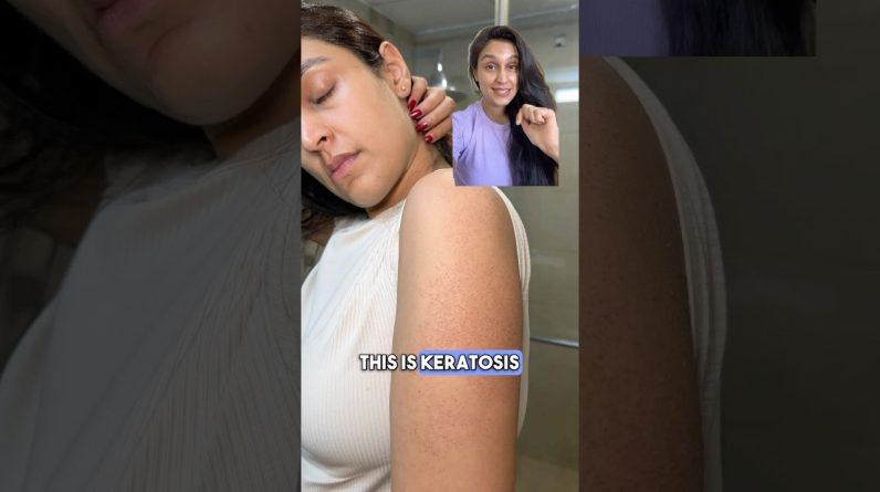 1768037837 maxresdefault