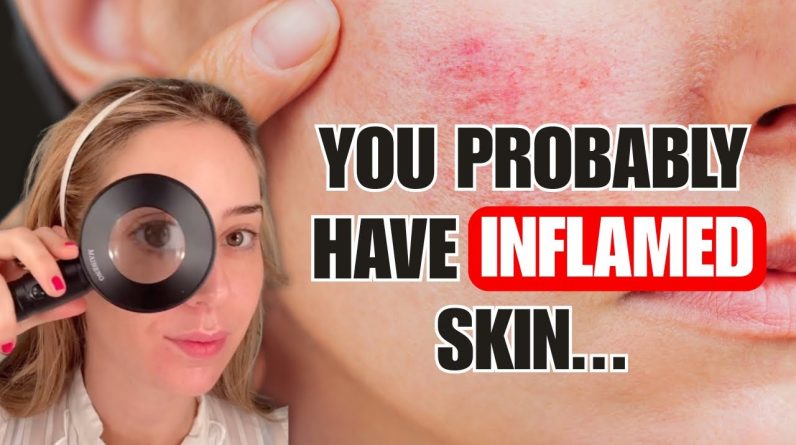 1768125227 maxresdefault