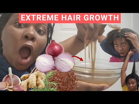 1768150843 hqdefault