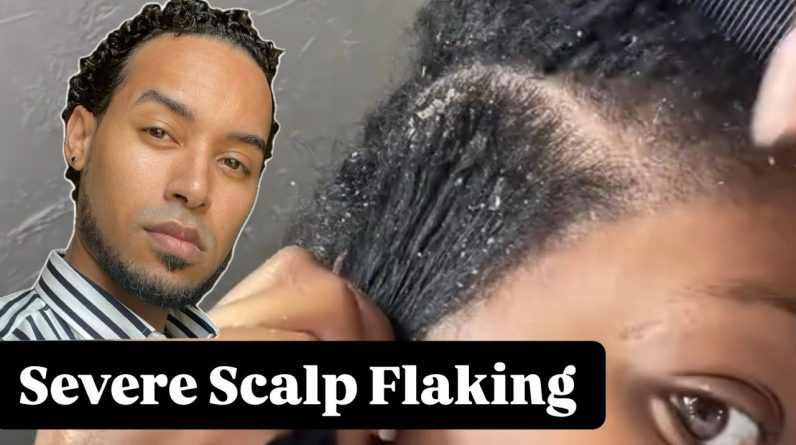 1768301401 maxresdefault