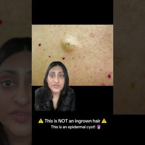 1768319520 maxresdefault