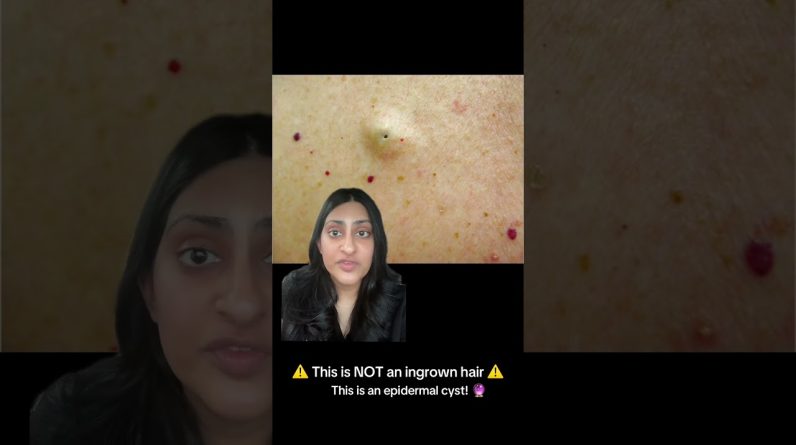 1768319520 maxresdefault