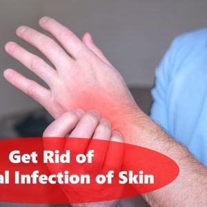 1768381388 maxresdefault