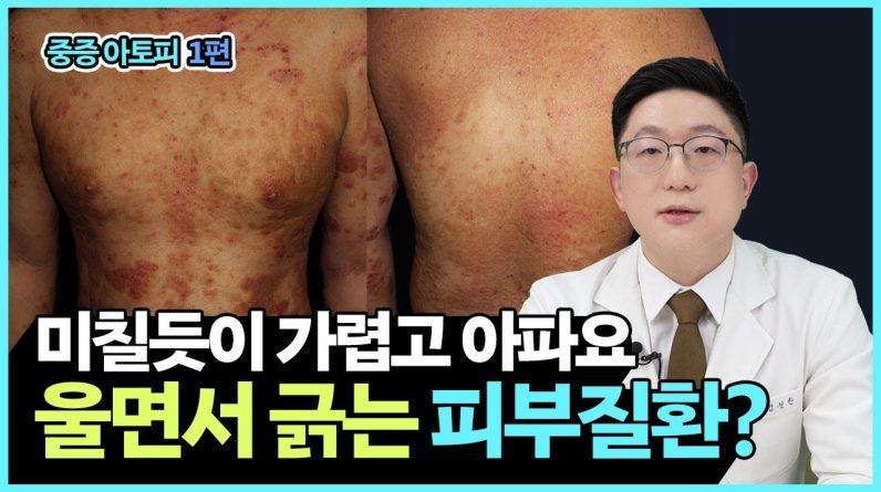 1768465912 maxresdefault