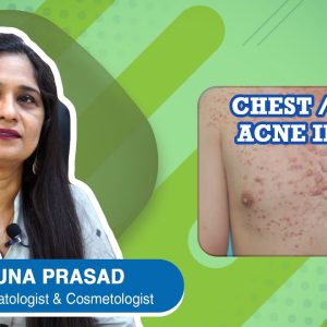 1768560906 maxresdefault