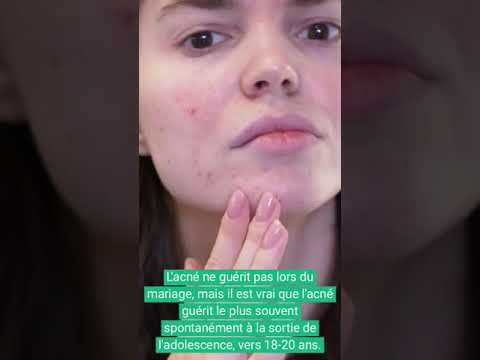 1768638242 hqdefault