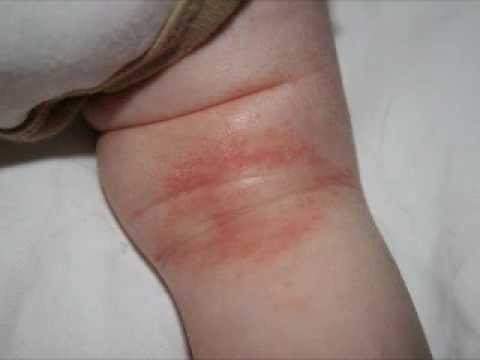 1768675050 hqdefault