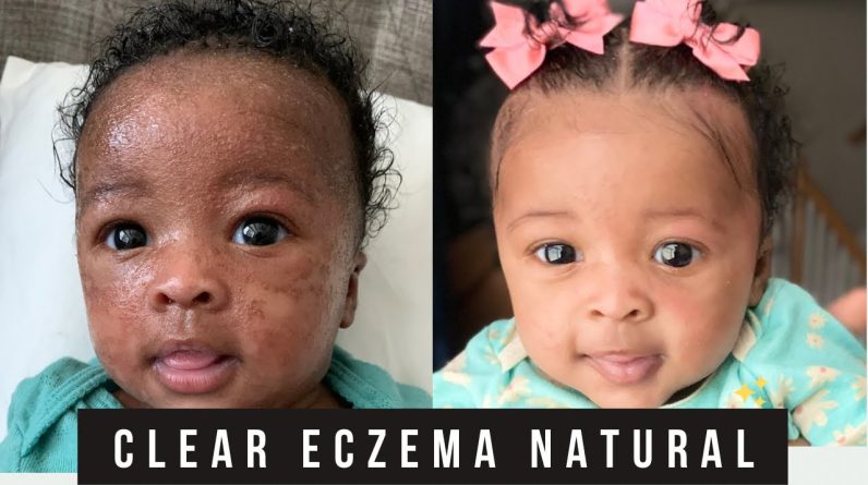 1768755632 maxresdefault