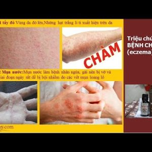 1768839704 hqdefault