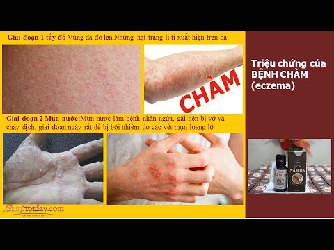 1768839704 hqdefault