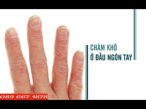 1768850698 hqdefault