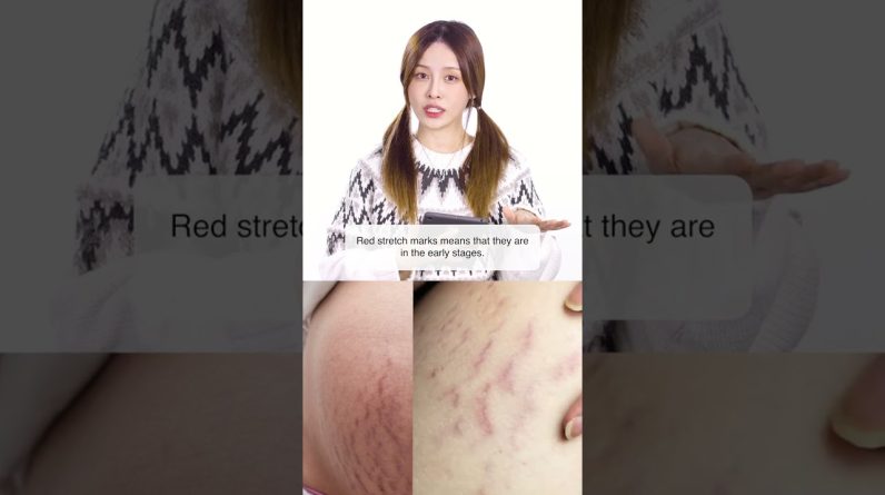 1768897726 maxresdefault