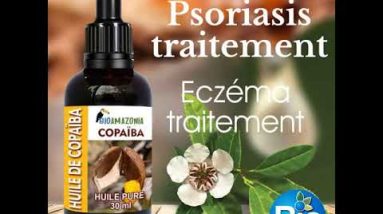 1768901869 hqdefault