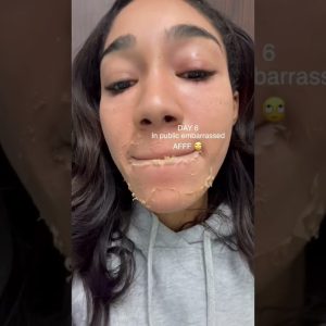 1768901936 maxresdefault