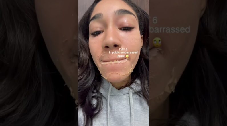 1768901936 maxresdefault