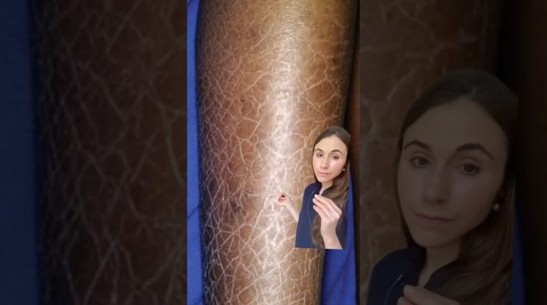 1768908802 maxresdefault