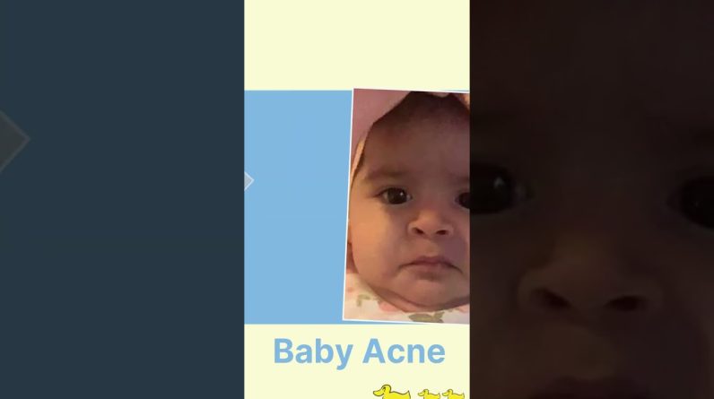 1768909562 maxresdefault