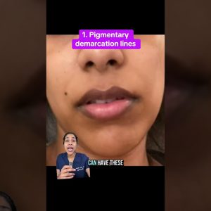 1768921156 maxresdefault