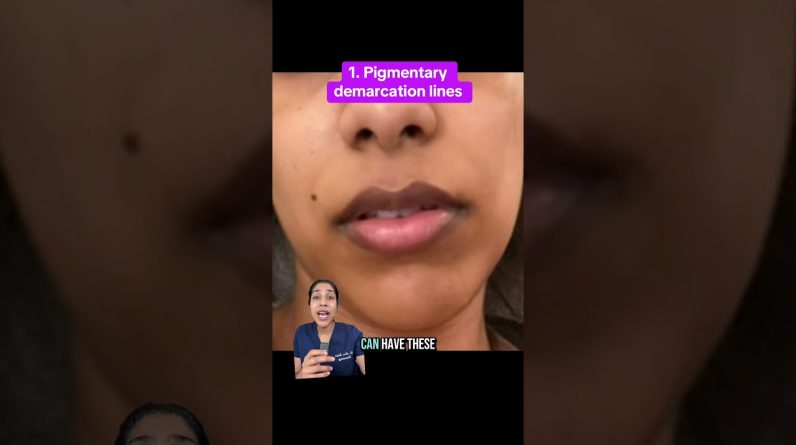 1768921156 maxresdefault