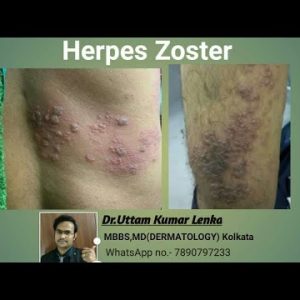 1768927567 hqdefault