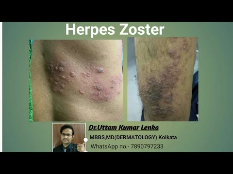 1768927567 hqdefault