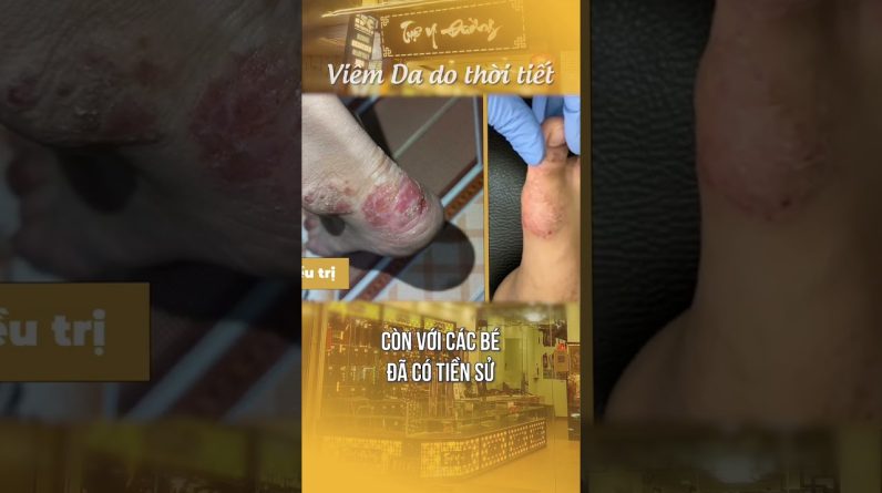 1768942228 maxresdefault