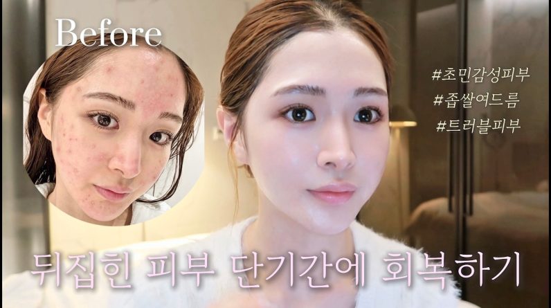 1768960009 maxresdefault