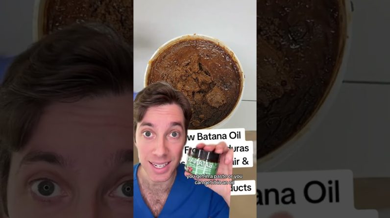 1769007649 maxresdefault