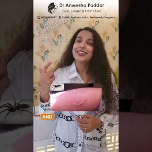 1769019224 maxresdefault