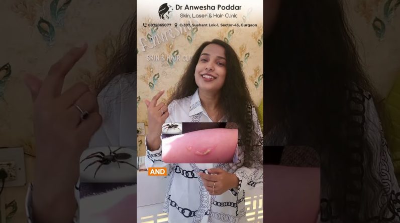 1769019224 maxresdefault