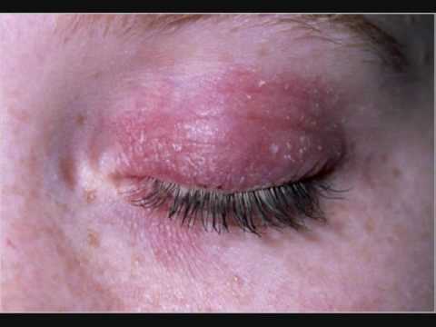 1769088905 hqdefault