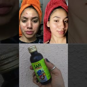 1769091915 maxresdefault