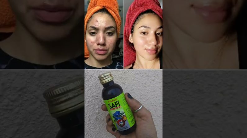 1769091915 maxresdefault