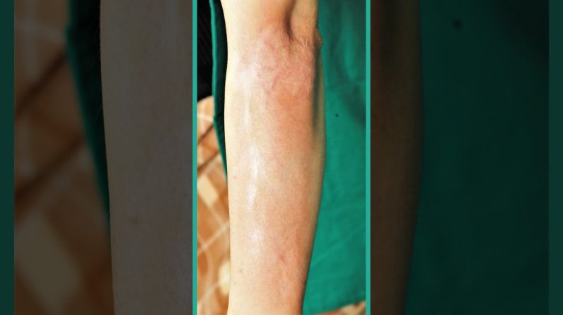 1769092543 maxresdefault