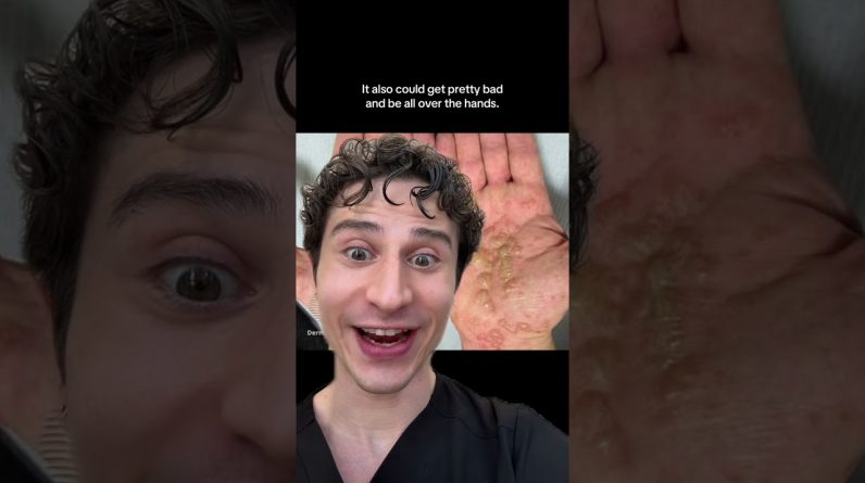 1769096942 maxresdefault