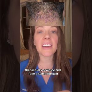 1769158544 maxresdefault