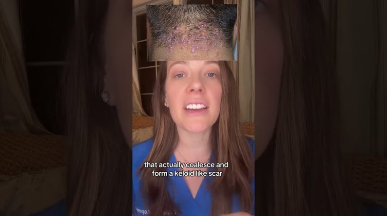 1769158544 maxresdefault