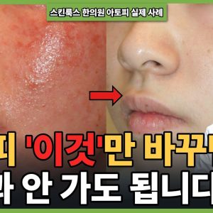 1769165686 maxresdefault